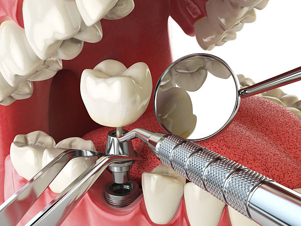 Best Emergency Denture Repair in Bloomingdale, GA